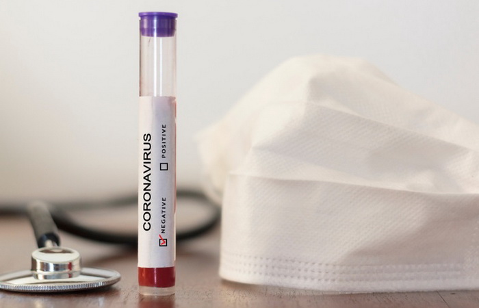 Šest testiranih na koronavirus u Sarajevu: Nalazi negativni