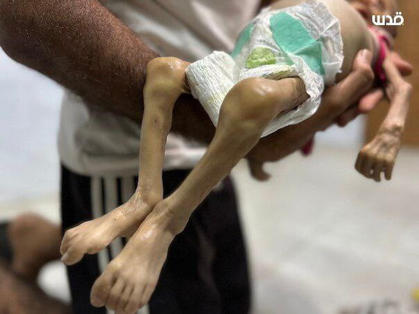 Šestomjesečna beba preminula majci na rukama u Gazi