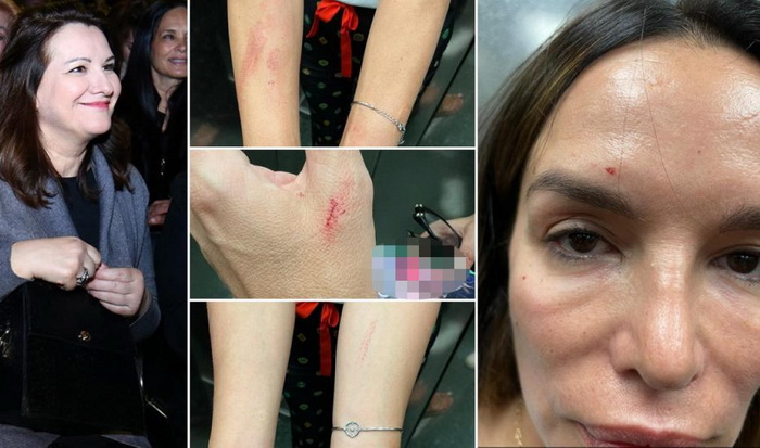 Severina uhićena na aerodromu nakon sukoba sa sestrom