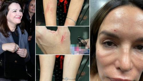 Severina uhićena na aerodromu nakon sukoba sa sestrom