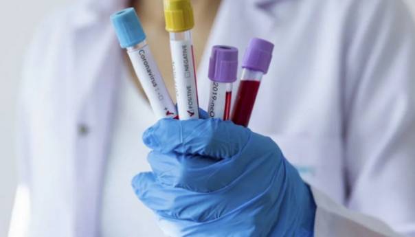 Sindikat doktora medicine i stomatologa KS osnovao Krizni štab