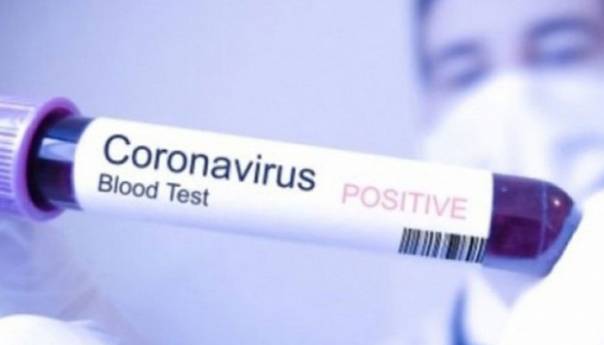 Slovenija: Broj zaraženih virusom korona povećan za 46