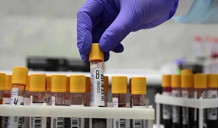 Slovenija kreće u masovno testiranje brzim testovima do kraja godine