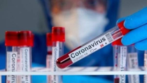 Slovenija prvi put bilježi više od 300 zaraženih