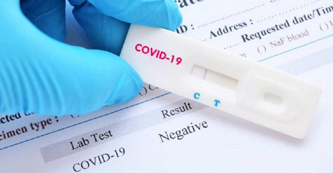 Slovenija: Raste broj novih zaraza, epidemiolozi strahuju od delta varijante