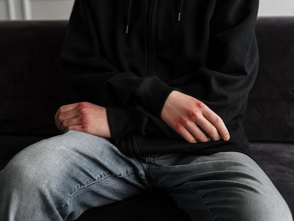 Slovenija: Svaki četvrti učenik bar jednom bio žrtva nasilja