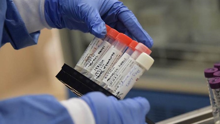 Slovenski ministar zdravstva skeptičan glede masovnog testiranja