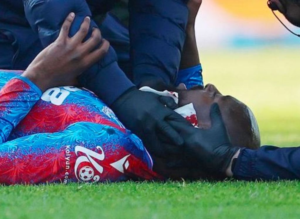 Slučaj Mateta: Užasna povreda i 25 šavova 