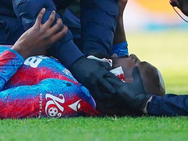 Slučaj Mateta: Užasna povreda i 25 šavova