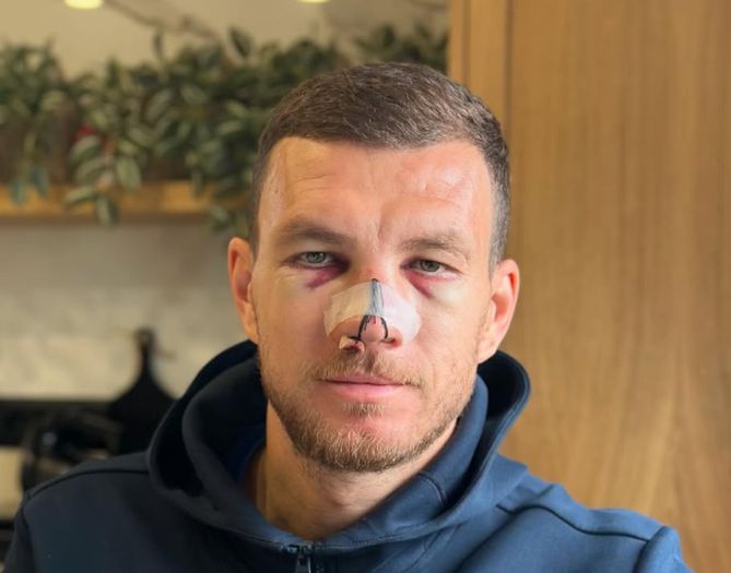 Španska Marca pisala o Džekinoj povredi: "Ratnik bez presedana"