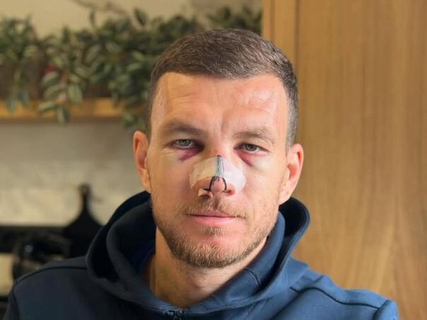 Španska Marca pisala o Džekinoj povredi: "Ratnik bez presedana"