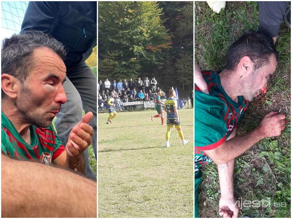 Sramota na fudbalskoj utakmici kod Lukavca: Pretučen fudbaler, igrači se tukli palicama, ganjali satarom i prijetili pištoljem