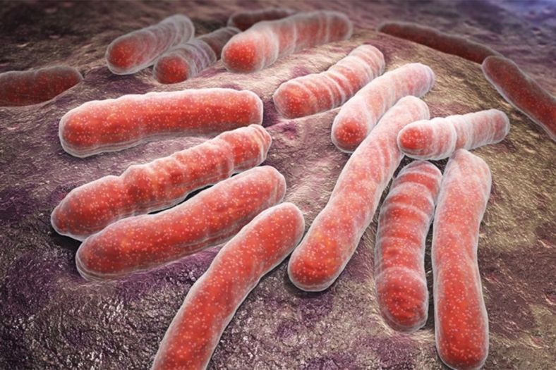 Šta je meningokokna sepsa od koje je preminulo dijete iz Visokog