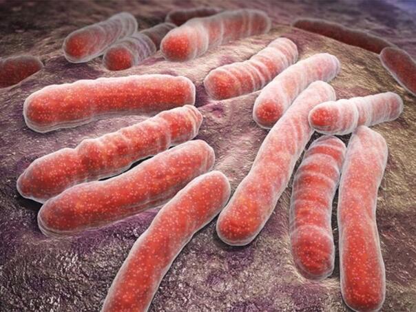 Šta je meningokokna sepsa od koje je preminulo dijete iz Visokog