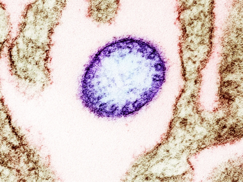 Šta je neizlječivi virus Nipah zbog kojeg je Azija na nogama?