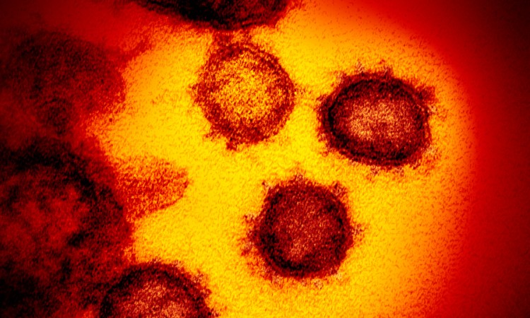 Šta virus korona radi ljudskim organima?