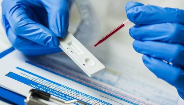 Što vam testovi na antitijela mogu reći, a što ne?