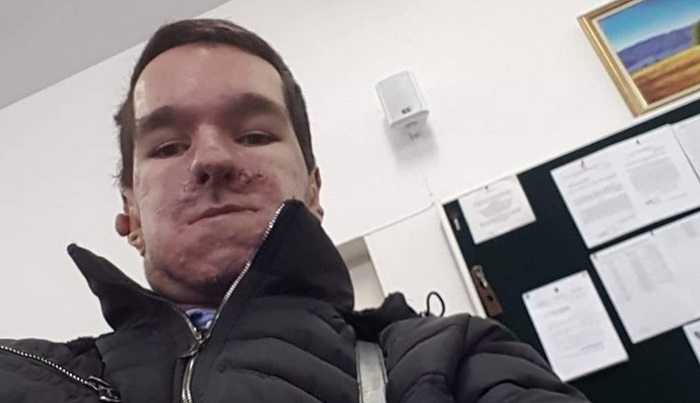 Stoprocentni invalid sa VSS Alen Hedo počinje raditi u Gradskoj upravi