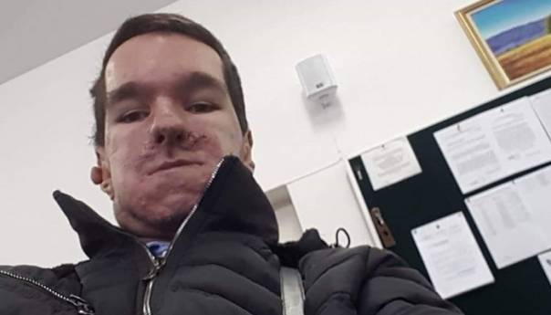 Stoprocentni invalid sa VSS Alen Hedo počinje raditi u Gradskoj upravi