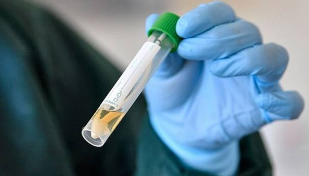 Stožer ZHK-a naložio obvezno testiranje zaposlenika u domovima za stare osobe
