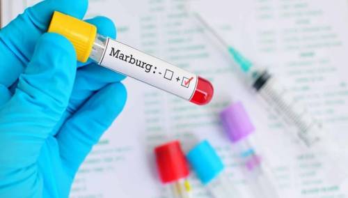 Sumnja se na prvi slučaj marburške virusne bolesti u Španiji