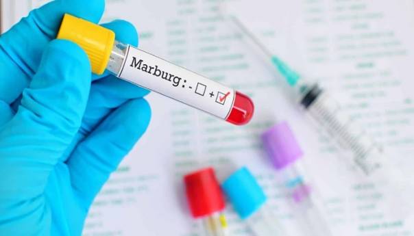 Sumnja se na prvi slučaj marburške virusne bolesti u Španiji