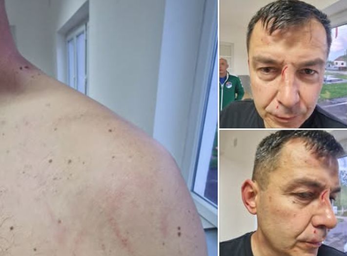 Sve 'čari' bh. fudbala: Predsjednik kluba sa sinom pretukao sudiju