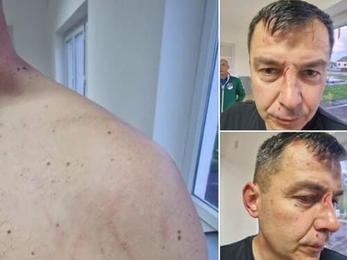 Sve 'čari' bh. fudbala: Predsjednik kluba sa sinom pretukao sudiju