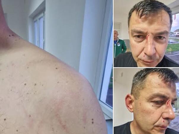 Sve 'čari' bh. fudbala: Predsjednik kluba sa sinom pretukao sudiju