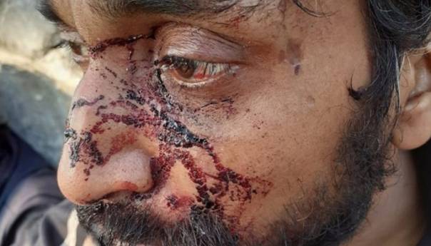 Svjedočenja: Policija u Hrvatskoj pet sati prebijala migrante