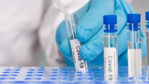 Svjetska zdravstvena organizacija donirala 60.000 PCR testova za BiH