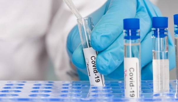 Svjetska zdravstvena organizacija donirala 60.000 PCR testova za BiH