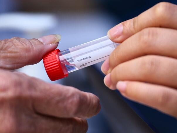 Test sline mogao bi otkriti skriveni rizik od zatajenja srca