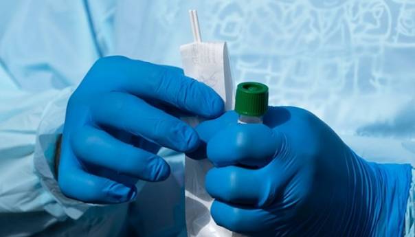 Testirani novi uzorci, jedan pozitivan za osobu iz Bihaća