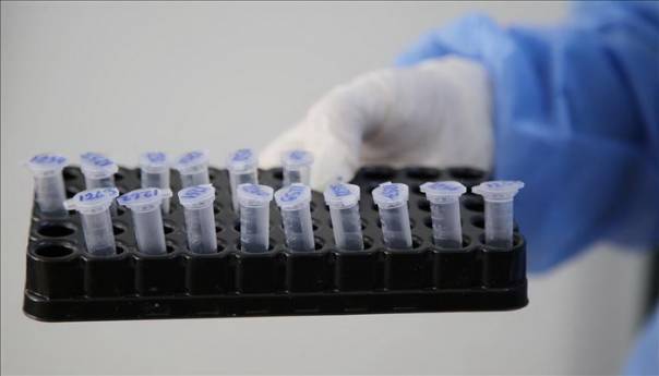 Testovi na koronavirus iz BiH ipak ne važe za ulazak u Sloveniju