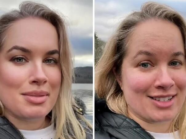 TikTok će blokirati filtere za uljepšavanje, razlog je mentalno zdravlje