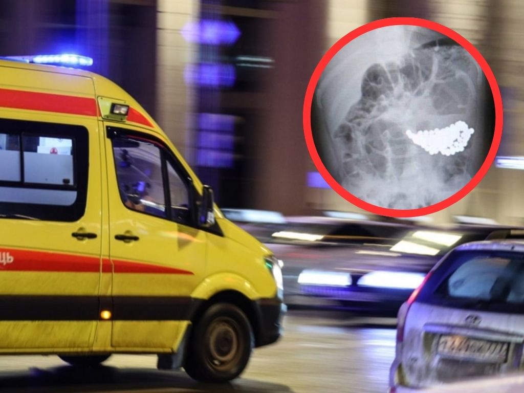 Tragedija u Rusiji: Dječak (2) preminuo nakon što je odjednom progutao 18 magneta