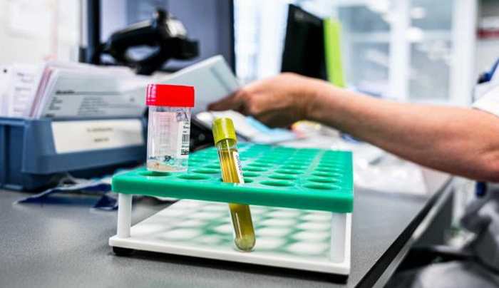 Tri nova slučaja koronavirusa u Bosni i Hercegovini