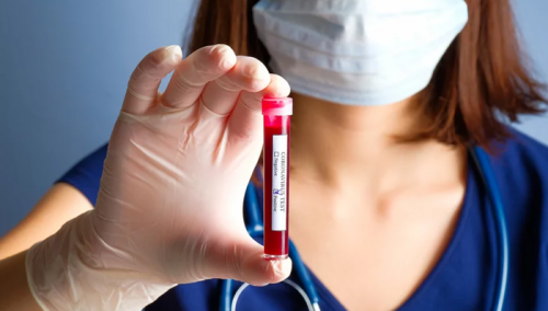 Tri nova slučaja koronavirusa u Sarajevu