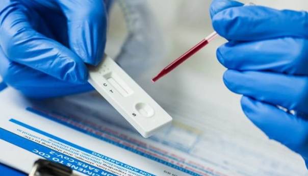 Trinaest dana bez novih slučajeva covida-19 u HBK-u