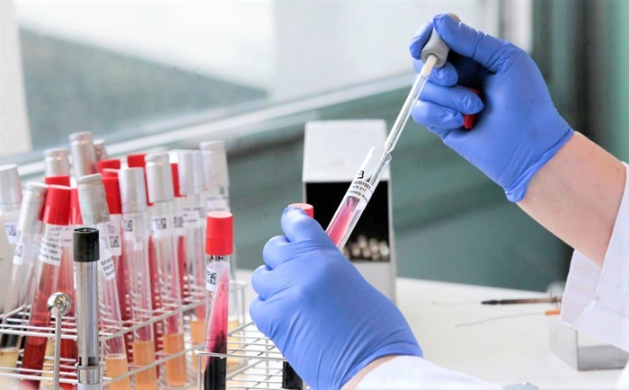 Trumpova administracija dodijelila 1,3 milijardi dolara za brze testove na virus