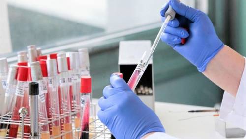 Trumpova administracija dodijelila 1,3 milijardi dolara za brze testove na virus