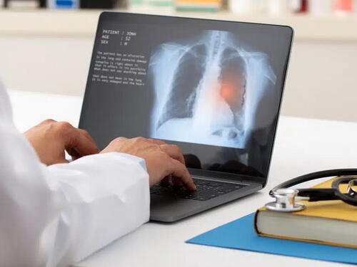 Tuberkuloza u svijetu odnosi više od milion života godišnje