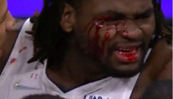 Tuča na utakmici: LeBron James udario protivnika i zaradio isključenje