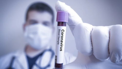 Turska nije spremna, imamo malo testova, a pola miliona smo dali SAD-u