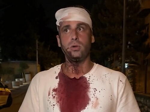 U Beogradu pretučen zastupnik: Šipkama su me udarali po glavi