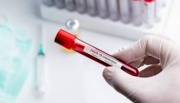 U BiH 158 novooboljelih i dva smrtna slučaja od koronavirusa