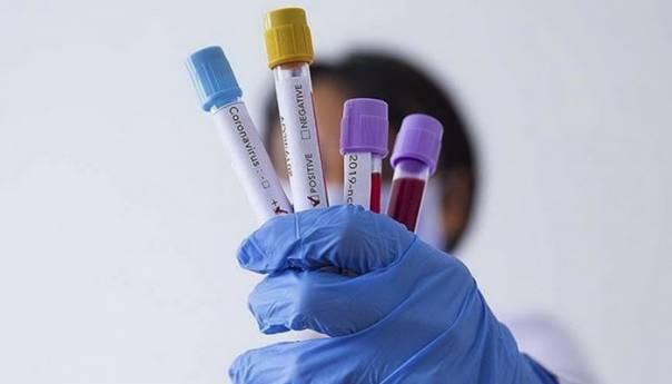 U BiH 183 novozaražene osobe, sedam umrlih