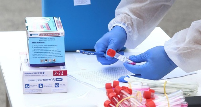 U BiH 233 nova slučaja koronaviursa, preminulo pet osoba