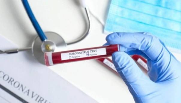 U BiH 281 novooboljelo od korone, umrlo sedam osoba